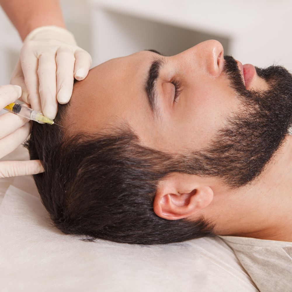 Mesoterapia Capilar